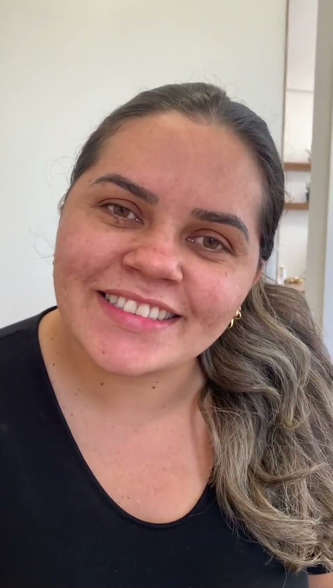 Depoimento em vídeo da paciente Elisangela