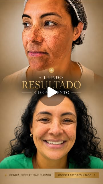 Depoimento em vídeo da paciente Lu